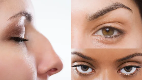 get rid of dark circles