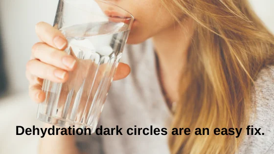 get rid of dark circles